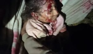 बैतडीको खोडपेमा बस दुर्घटना ९ जना को मृत्यु ३४ घाइते